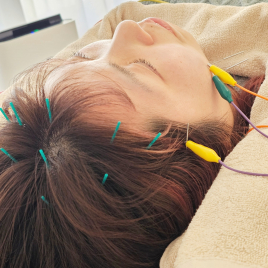 Harienju ハリエンジュ 鍼灸サロン 電気を流す優しい頭皮鍼のメニュー画像