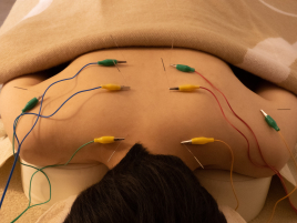 美容鍼灸サロンamo 【オプション】背部鍼通電　のメニュー画像