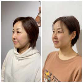 はり院　minamoto   ルート治療専門 ルート鬼美容鍼のメニュー画像