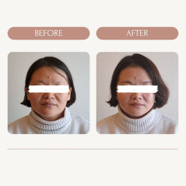 鍼灸サロンmiyabi 背面 + 造顔リンパ &小顔美容鍼のメニュー画像