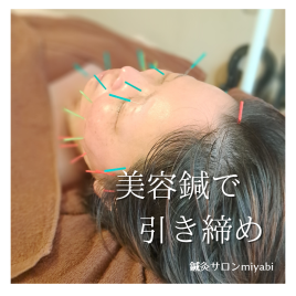 鍼灸サロンmiyabi 背中 + 造顔リンパ & 小顔美容鍼のメニュー画像