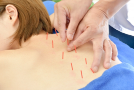 KIKUCHI鍼灸サロン 首肩こり、腰痛治療コースのメニュー画像