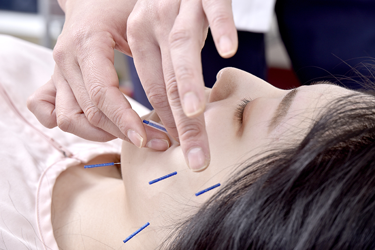 女性のための鍼灸院・マッサージ院-ゆしんアネックス- 初回美容鍼灸施術のメニュー画像