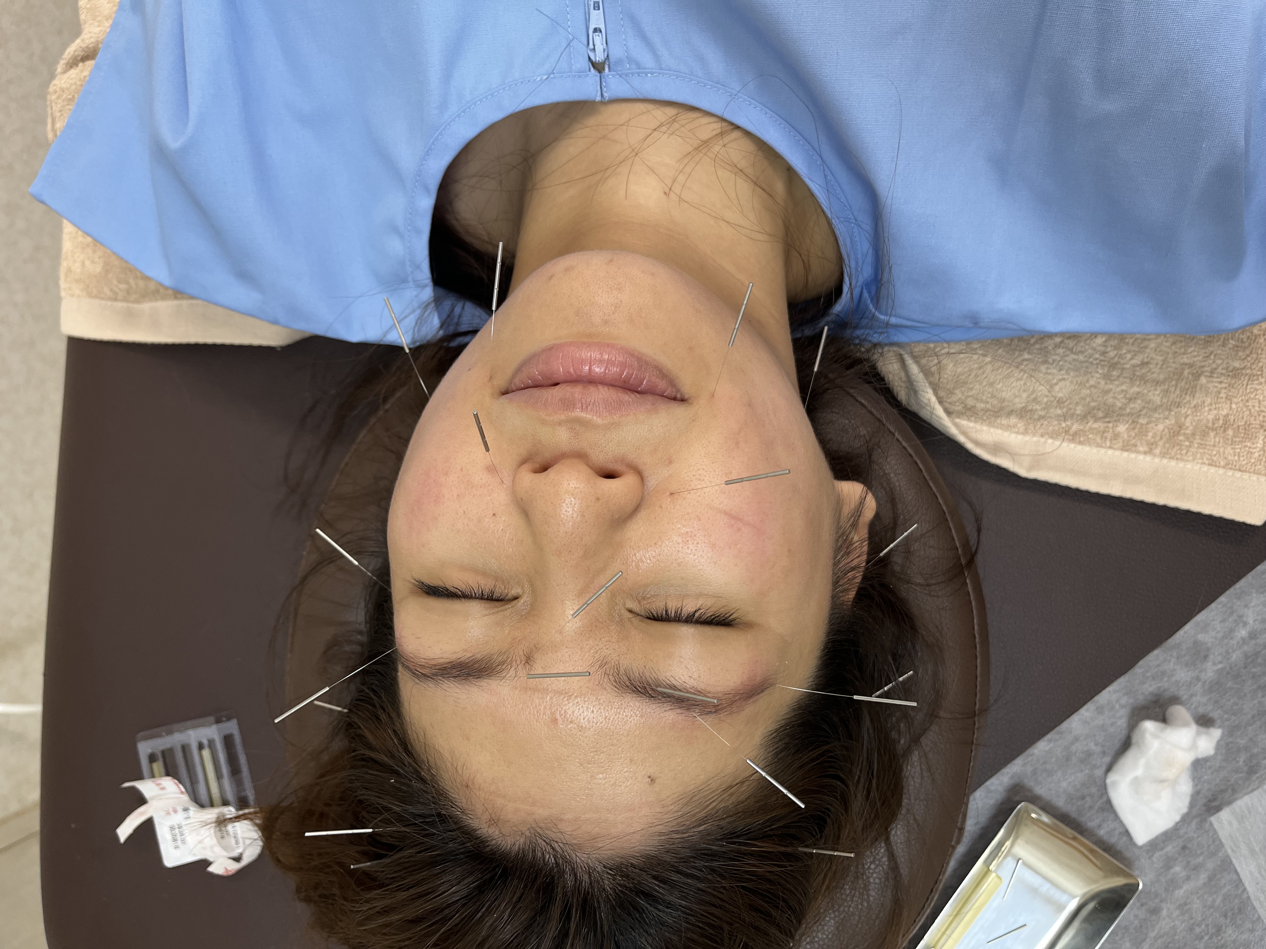 フラン鍼灸治療室 美容針コースのメニュー画像