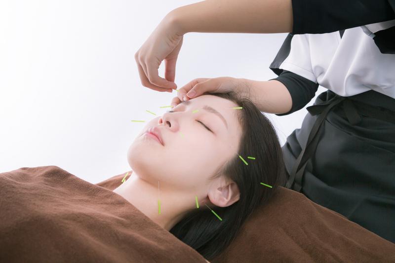Kiito美容鍼灸院 【初回限定】美容鍼トライアルコースのメニュー画像