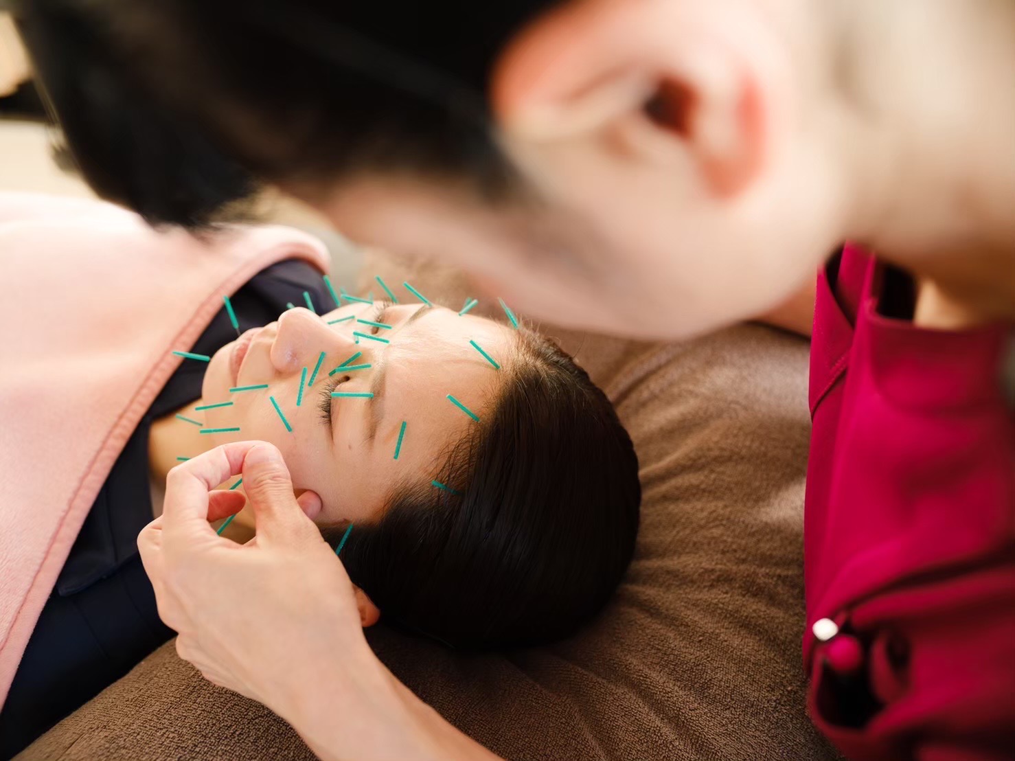 田中美骨整体鍼灸院 美容鍼スペシャルコース（初回）のメニュー画像