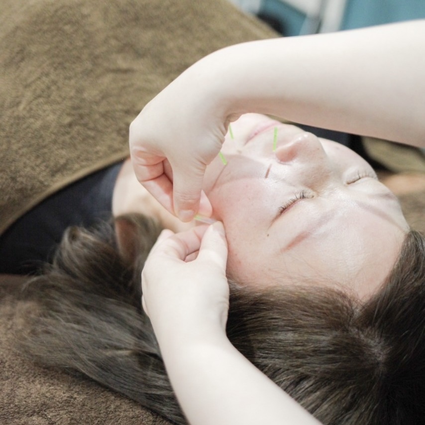 はりきゅうマッサージサロンLimana ベーシック美容鍼灸４０分のメニュー画像